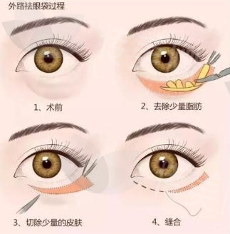 微信截图_20240408094537.png