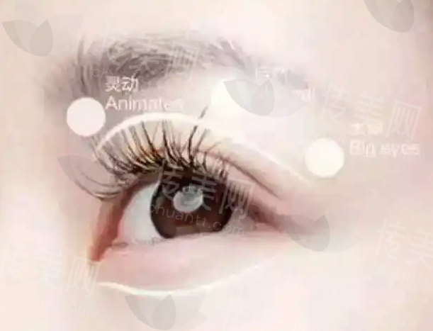 成都林靖做双眼皮技术怎么样?技术出色尤其是双眼皮修复,手法一绝
