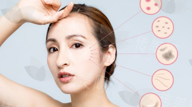 20+做什么项目好?来试试性价比最高的黄金微针