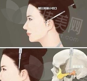 微信截图_20240411103706.png