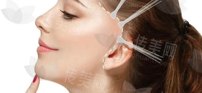 微信截图_20240412154236.png