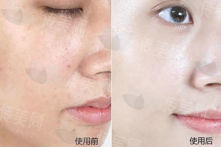 郑州地区的抗衰项目,哪家医院做得好?郑州美莱榜上有名!