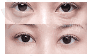 1535372116664785_new.png