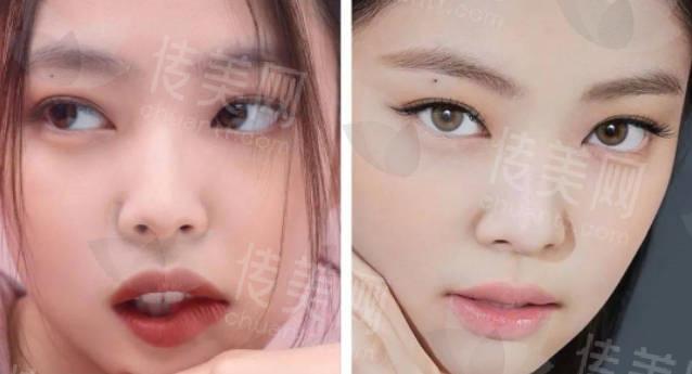 上海杜园园口碑如何?眼修复大佬杜园园修复价格较高,是为何?
