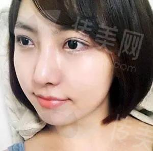 u=3039432684,1972008911&fm=253&fmt=auto&app=138&f=JPEG.jpg