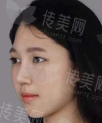榜单公布:十堰有隆鼻做得好的医院吗?数量不少!