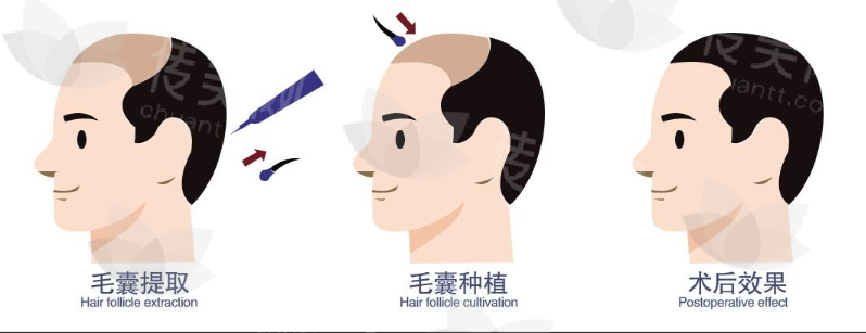 微信截图_20240627135417.png