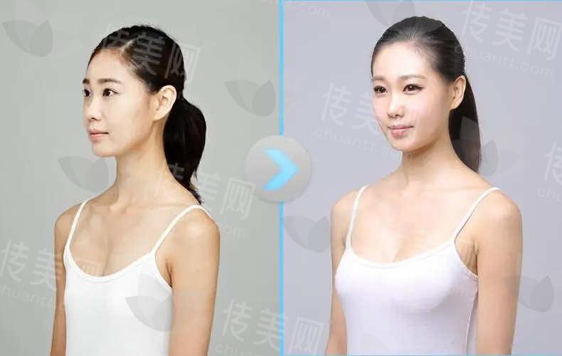 丰胸3.jpg