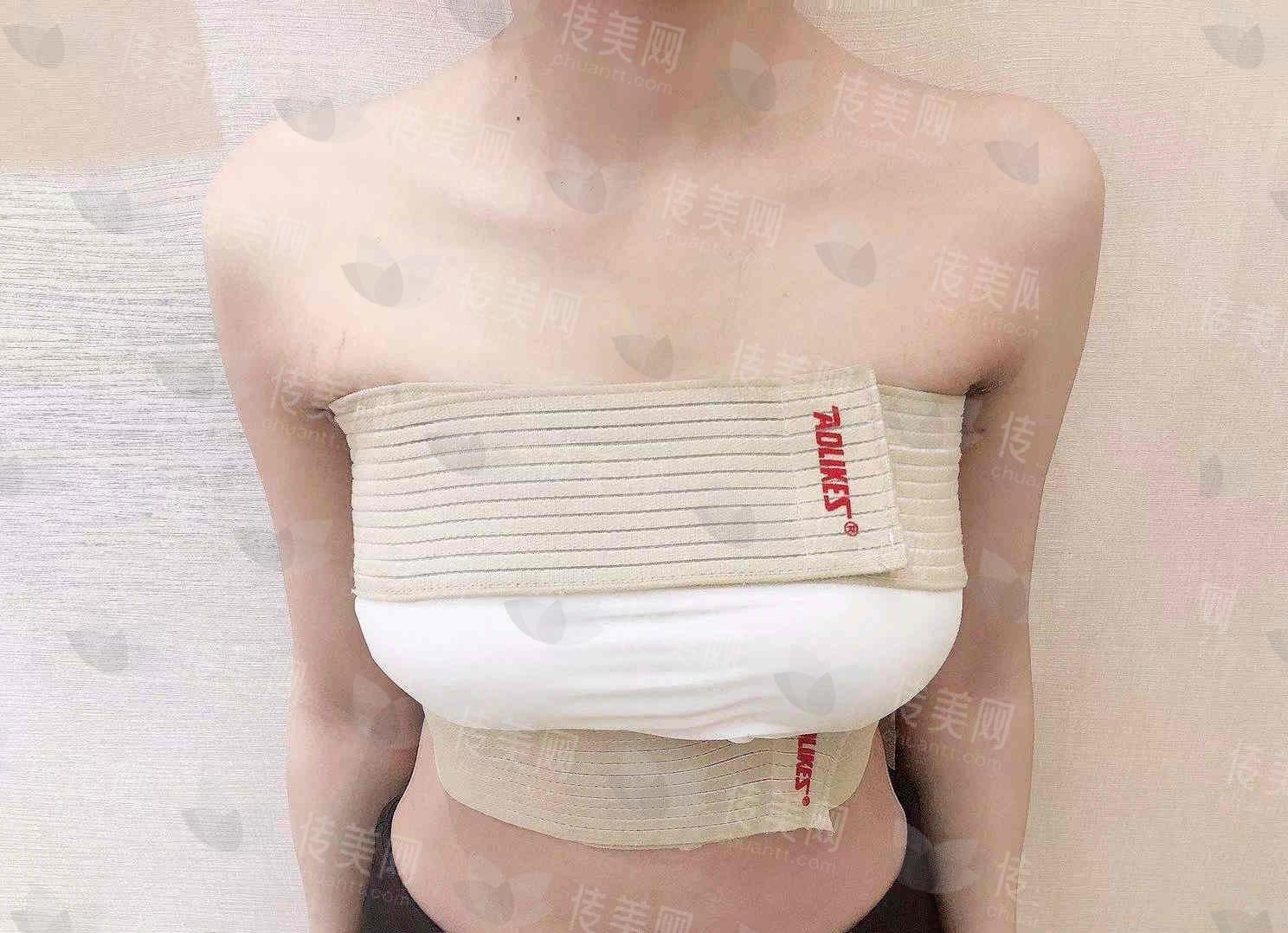 隆胸.jpg