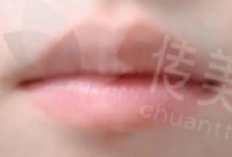 唇1.png