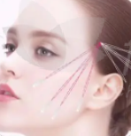 拉皮6.png