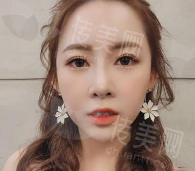 排名揭晓:鼻尖不够翘,像做隆鼻?湘潭隆鼻医院排名来了,附上美多多,雅美,阳光医美的综合比较