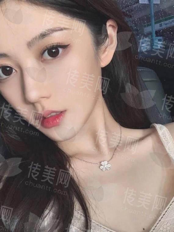 关注热点:北京米兰柏羽医疗美容特色项目是什么?北京米兰柏羽医疗美容钻石精雕鼻有多专业?
