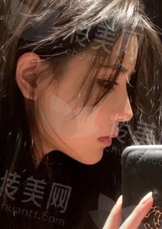 官方排名:湘西著名的隆鼻医生都有哪些?王变雨、刘志高、欧阳华等技术各有千秋