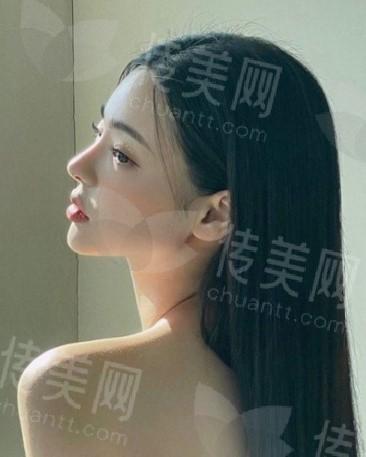 鼻3.jpg