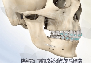 微信截图_20240731144219.png