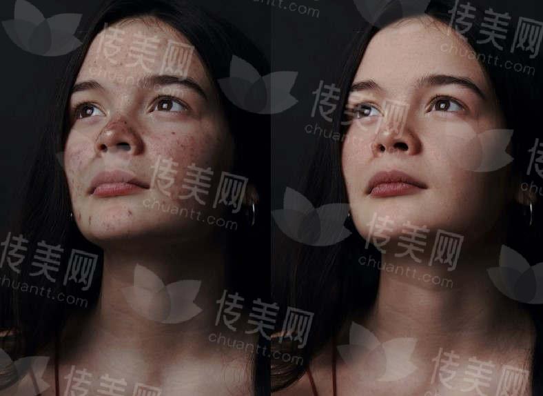 皮肤1.jpg