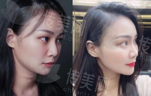 下巴2.jpg