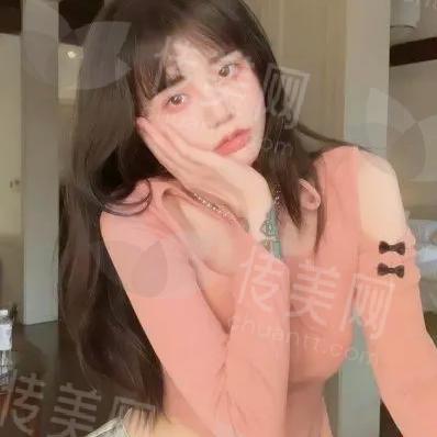 本周咨询:大连爱德丽格在哪里?刘志刚,王香平医生眼部整形双眼皮有多强?