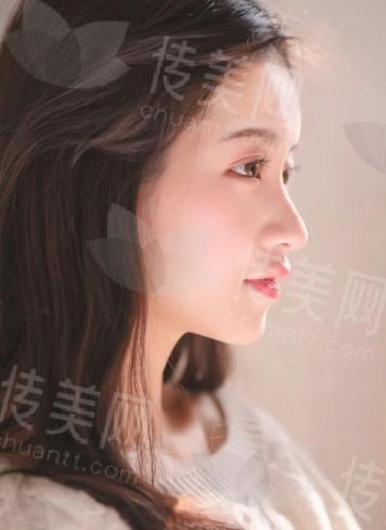 面部2.jpg