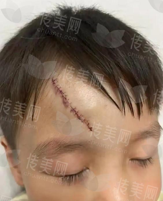 武汉美莱疤痕整形怎么样?央视采访专家于艳菊医生坐诊,手术地址交通便利