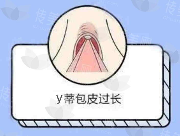 私密2.jpg