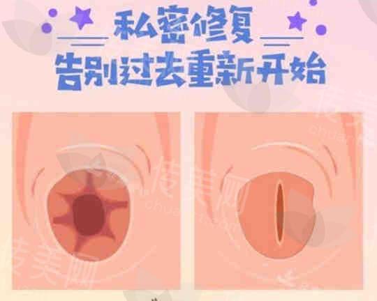 私密3.jpg