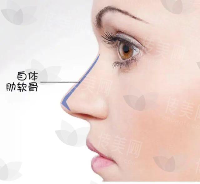 深圳阳光罗志敏修复鼻子怎么样?技术与口碑的双重保险