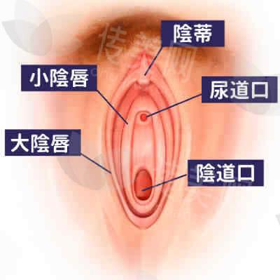 西安切除小阴唇找哪个医生好?西安国际医学中心的罗曼医生重磅推荐,价格8k起。附手术地址预约方式
