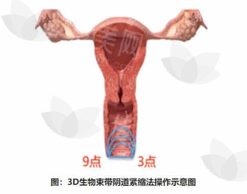 私密1.jpg