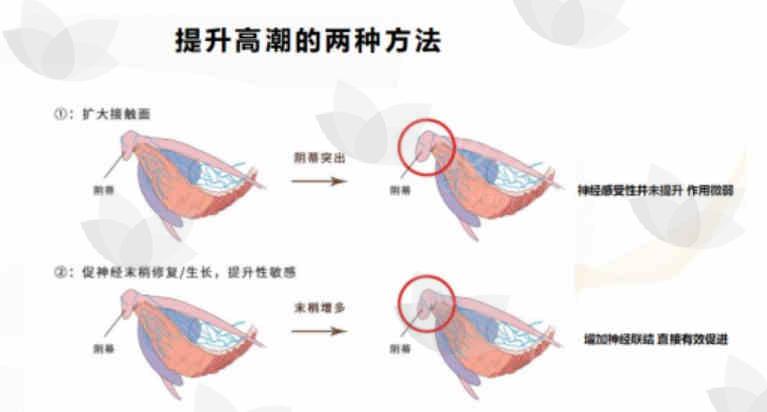 北京女性私密整形好医生:北京嘉禾整形侯智慧院长生物束带阴道紧缩小阴唇噶处女膜阴蒂包皮高潮针正规靠谱,附手术地址