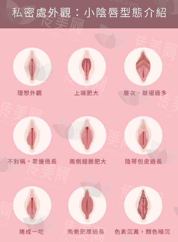 北京私密整形口碑专家：北京画美张蔚萱医生产后修复私密水嫩年轻化阴唇饱满粉嫩私密修复产后形体管理产后盆底肌好娠纹修复，附手术地址
