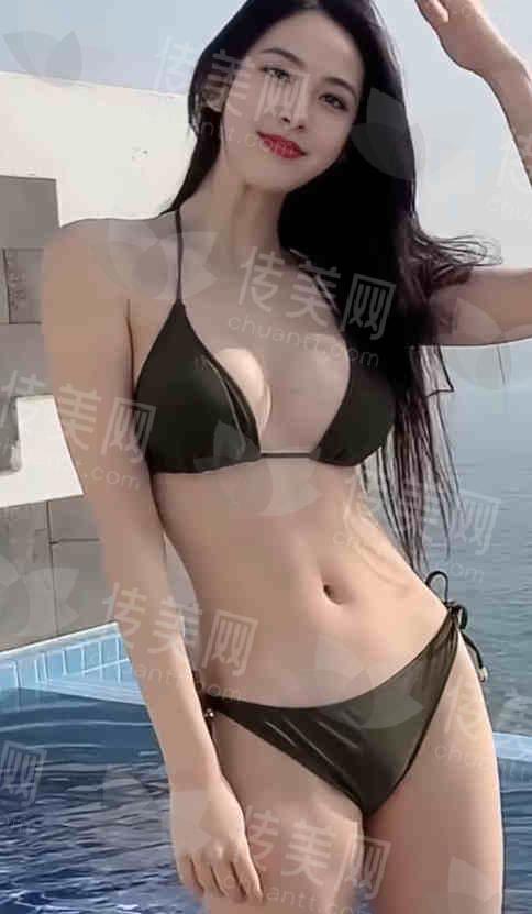 武汉隆胸好的专家:徐国建医生作为湖北头一个傲诺拉IMF隆乳术培训导师,很擅长假体丰胸下垂矫正等项目,附坐诊医院地址