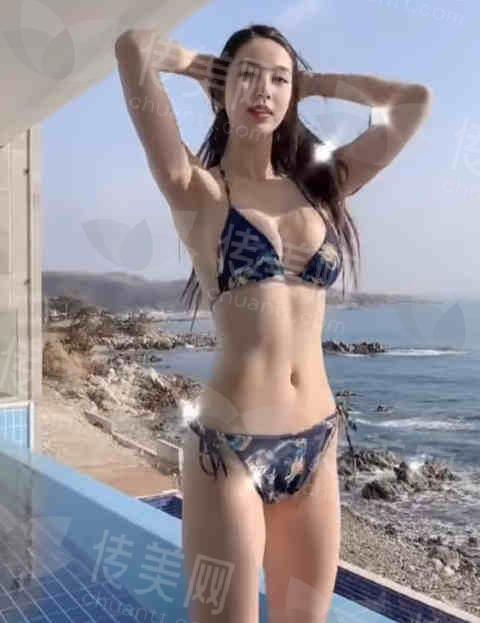 武汉隆胸叶子荣教授口碑好吗?怎么预约?武汉同济医院地址在哪儿?附预约方式