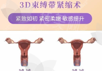 深圳私密阴道紧缩处女膜修复性快感增强口碑好医生推荐,深圳鹏程整形医院刘冰李子鹏王哲慧附医院介绍&医生介绍&价格