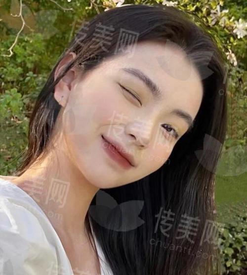 沈阳丰唇哪家医院最靠谱?协和、杏林、名流三大名院实力比拼!