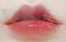 唇形矫正2.png