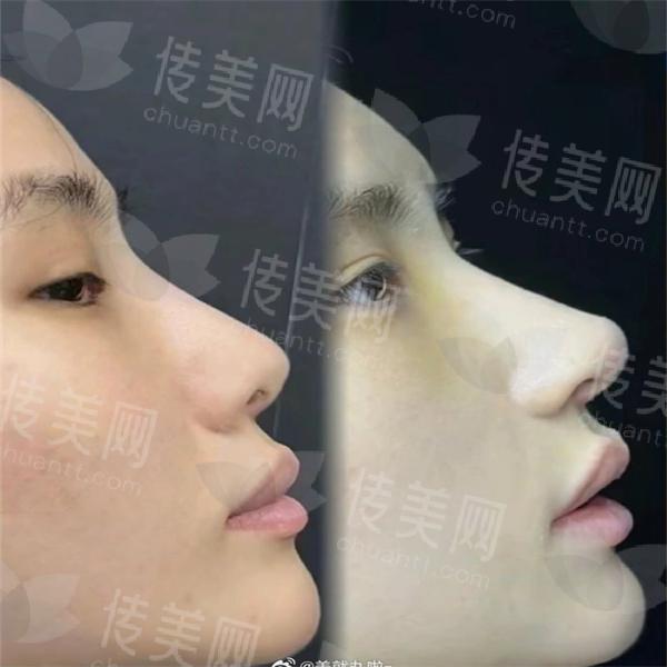 6ddb13dcly1hss4k4ha15j20j60pkdh0.jpg