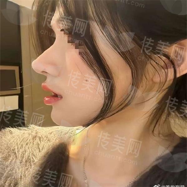 006CczE7ly1hs84l3afepj30j60pkjt5.jpg