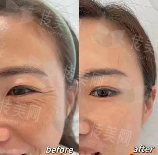 微信截图_20250106091220.png
