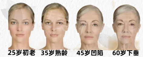 衰老2.png