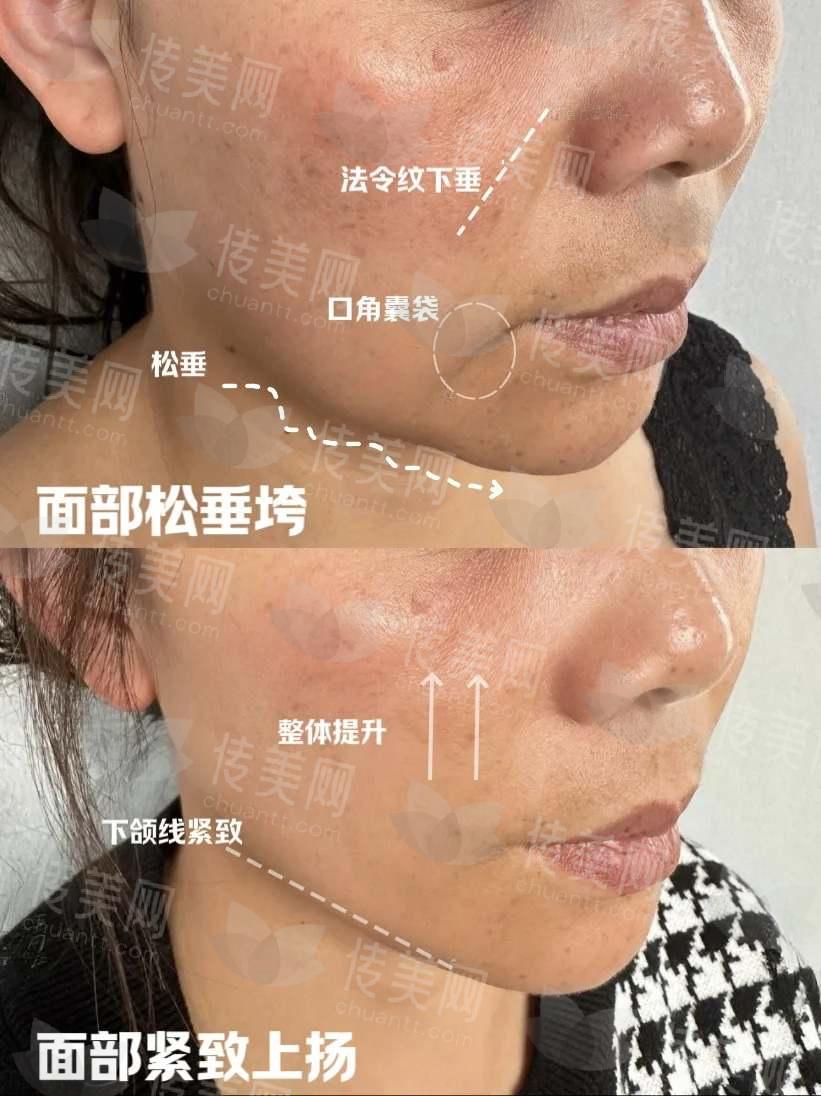 1736905928217516.jpg 抗衰思路|<span style=