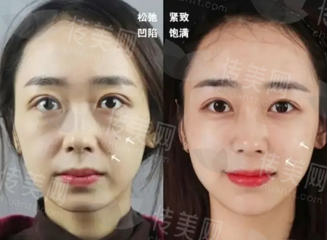 微信截图_20250102093137.png