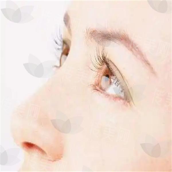 u=3878354800,2965016889&fm=253&fmt=auto&app=138&f=JPEG.jpg