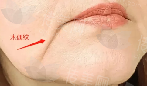 微信截图_20250116110424.png