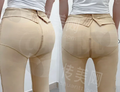 F.png
