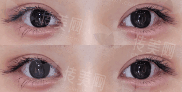 眼修.png
