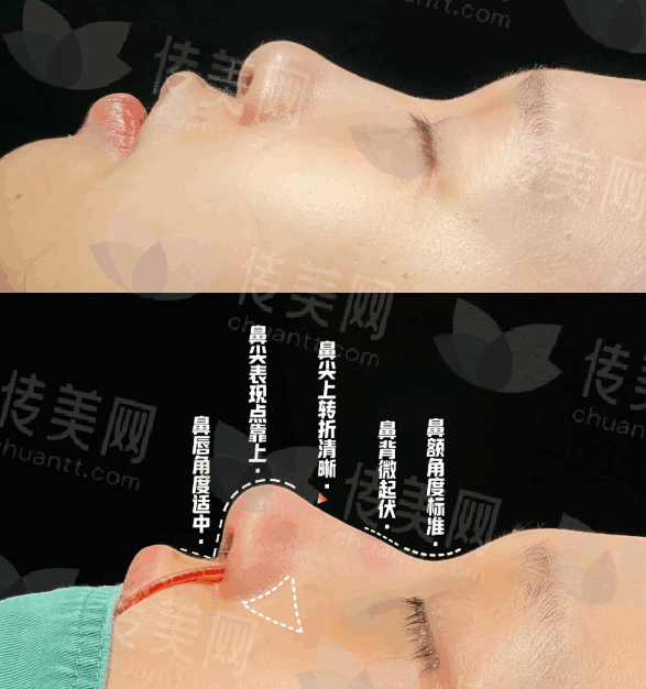 anl (1).png