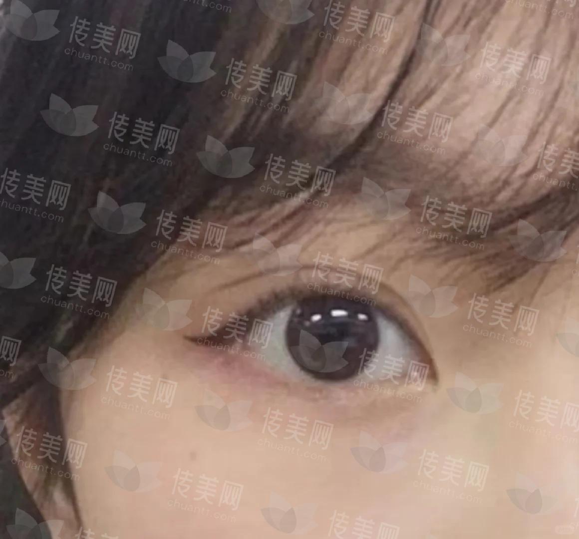 我要的 大白给我做的_1_渐行渐远_来自小红书网页版.jpg