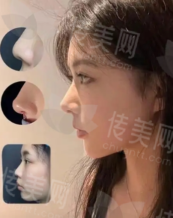 微信截图_20250123144419.png